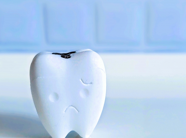 虫歯の痛みはどう変化する？痛みの対処法を紹介