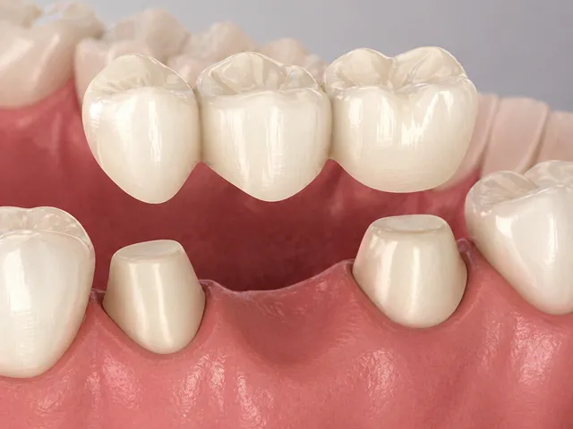 ブリッジのイメージ