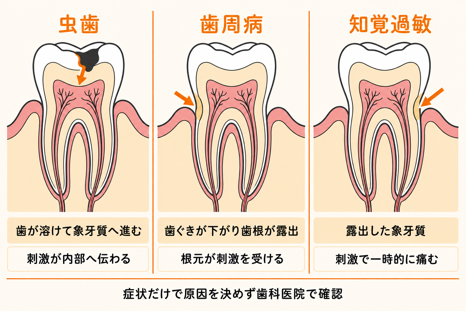 知覚 過敏 直し 方(02)