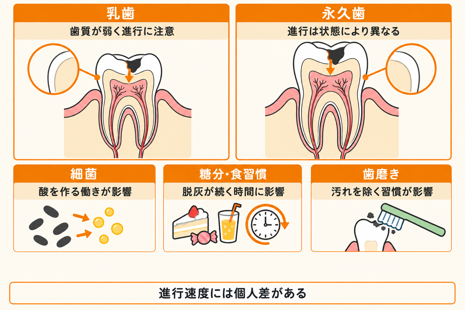 虫歯 進行 速度