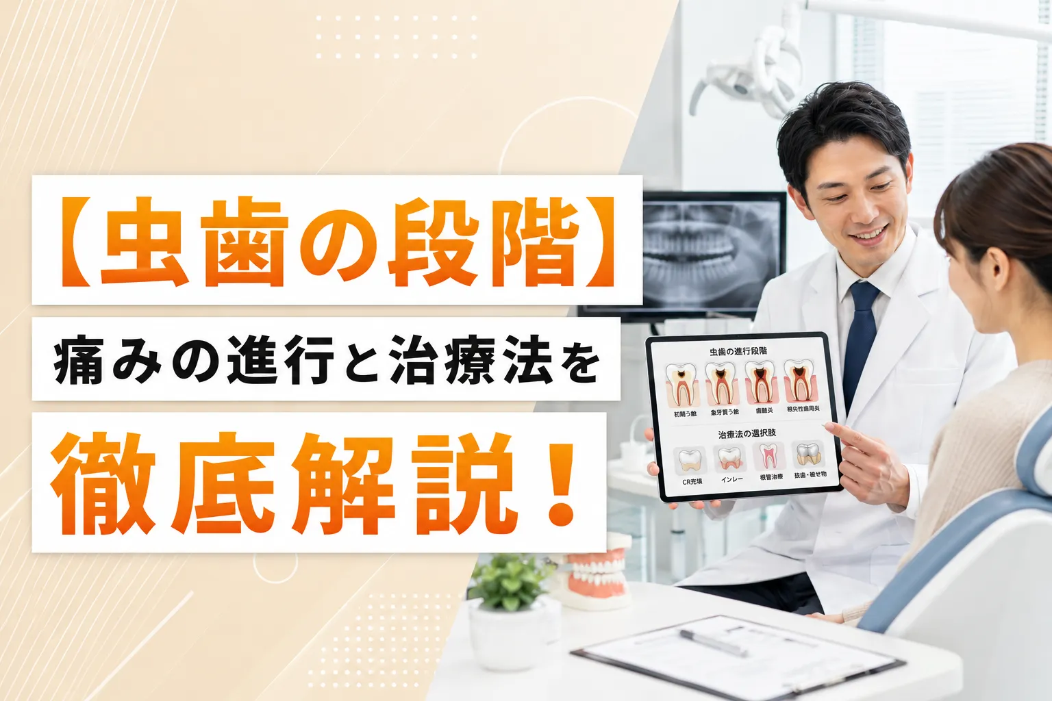 【虫歯の段階】痛みの進行と治療法を徹底解説！